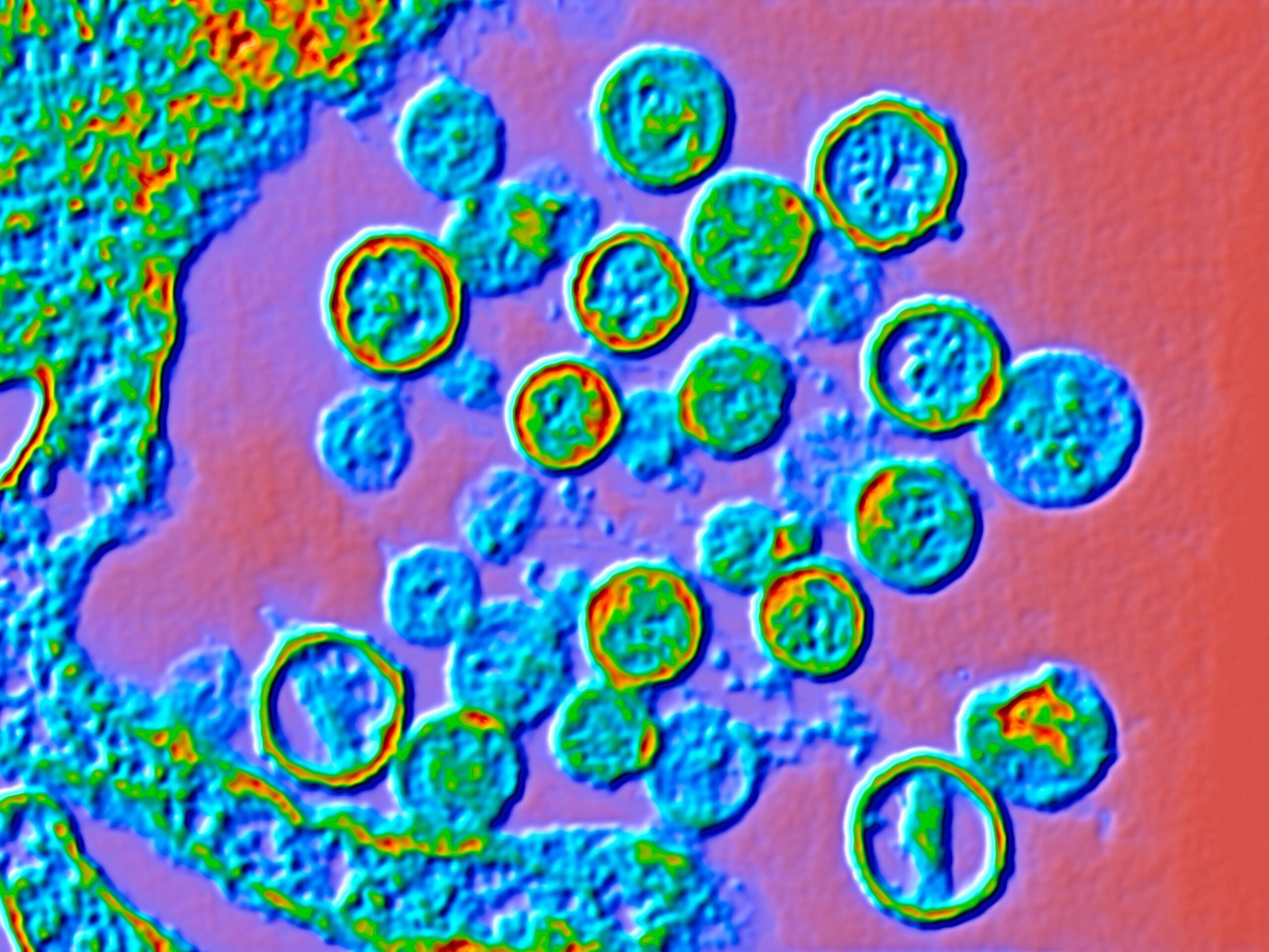 Hantavirus Infected Passengers Quarantined Amid Urgent Medical Screening